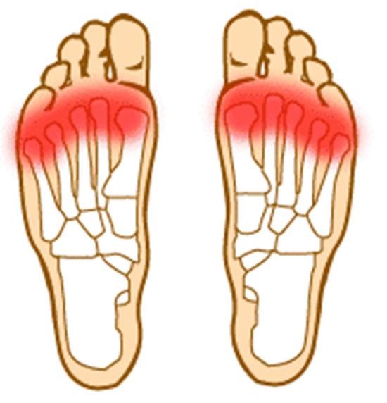 Common Areas Of Foot Problems Underneath The Feet